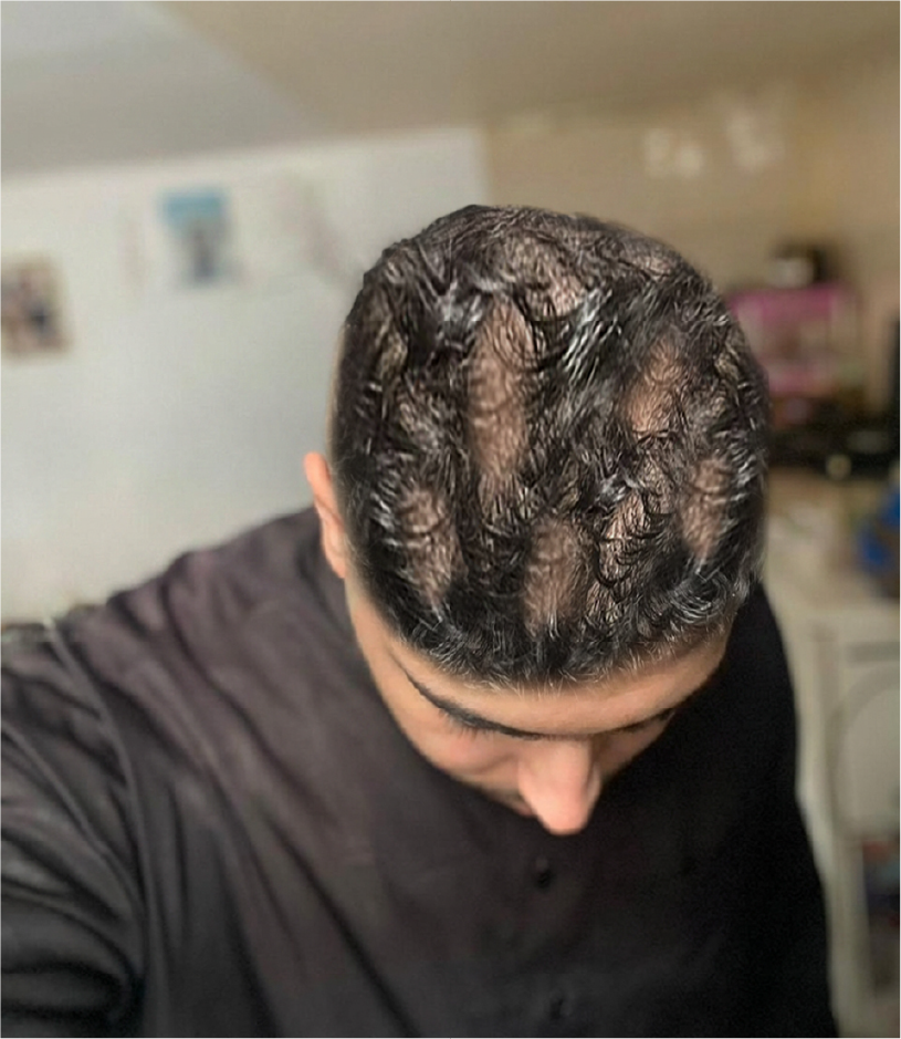 slider image
